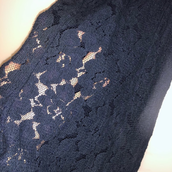 Hollister Lace Dress - Picture 3 of 3